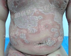 СС���꣬�¶���м��